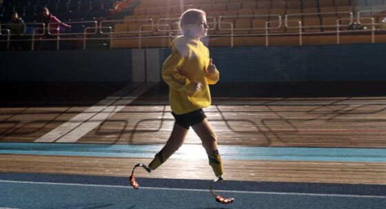 Kind mit gelber Jacke und Prothesen an beiden Beinen läuft in einer Sporthalle auf einer Laufbahn